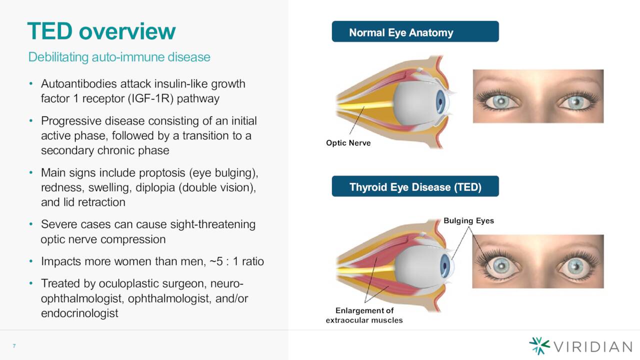 TED overview Normal Eye Anatomy